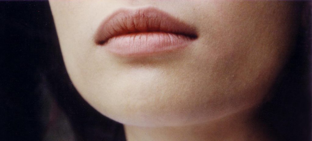 Soft natural treated lip enhancement
